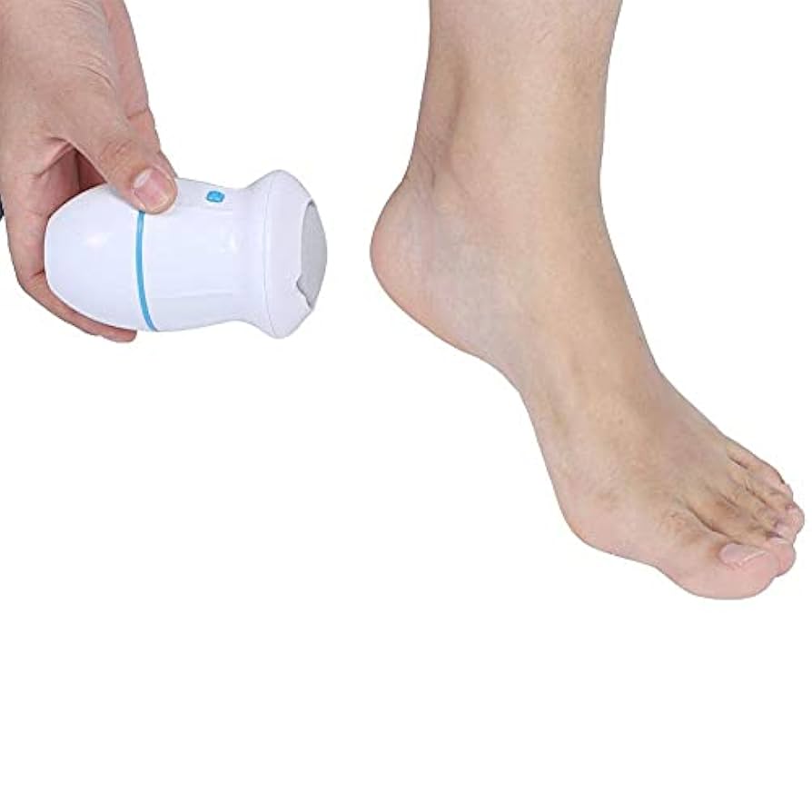 Amazon.com : Electric Feet Callus Remover, Battery Operated